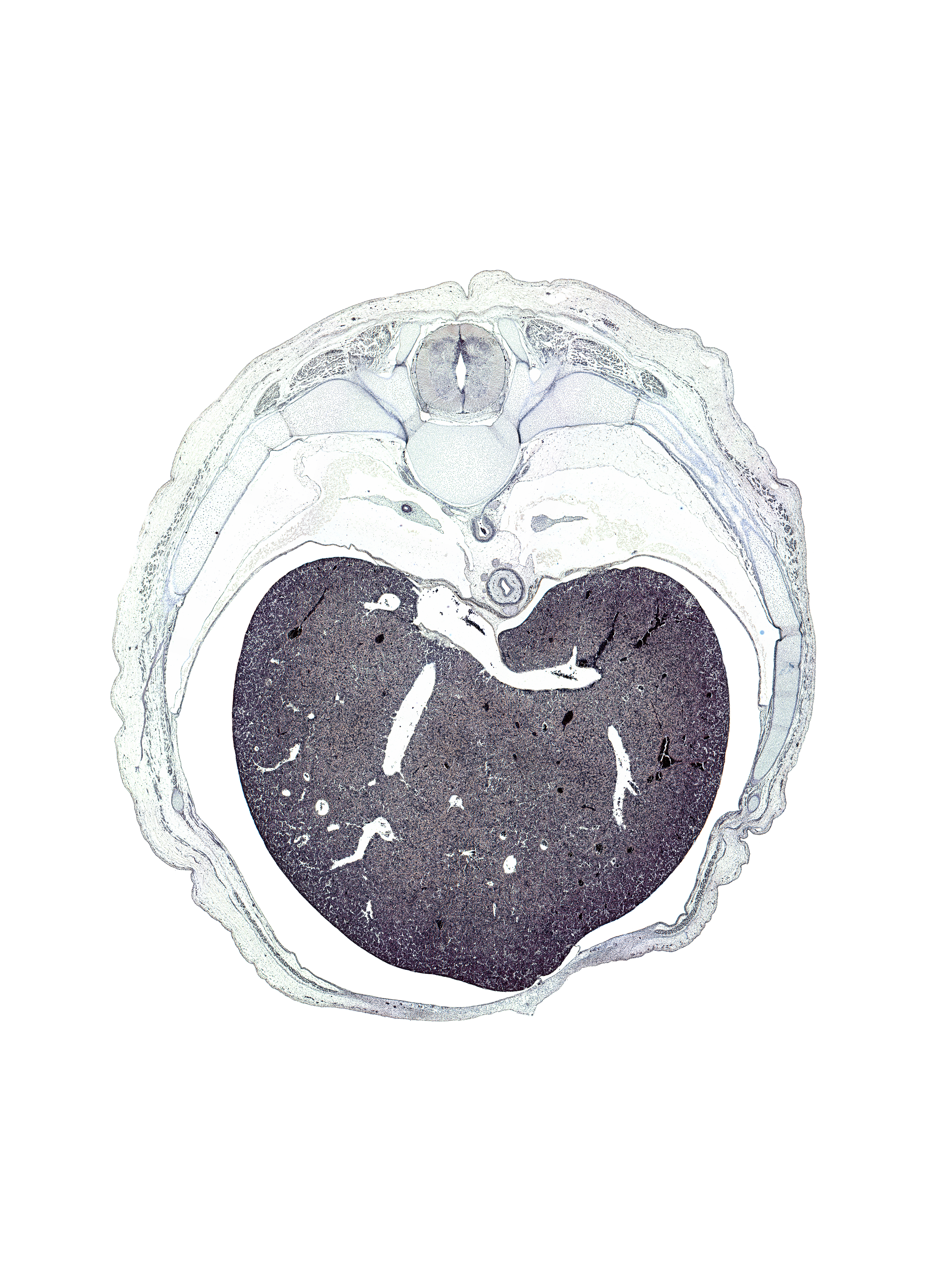 T-8 / T-9 interganglion region, caudal edge of lower lobe of left lung, efferent hepatic vein, efferent hepatic veins, iliocostalis muscle, inferior vena cava, latissimus dorsi muscle, left lobe of liver, longissimus muscle, lower lobe of right lung, multifidus muscle, pedicle of T-8 vertebra, peritoneal cavity, rectus abdominis muscle, rib 10, rib 9, right lobe of liver, spinalis muscle, transverse process of T-8 vertebra