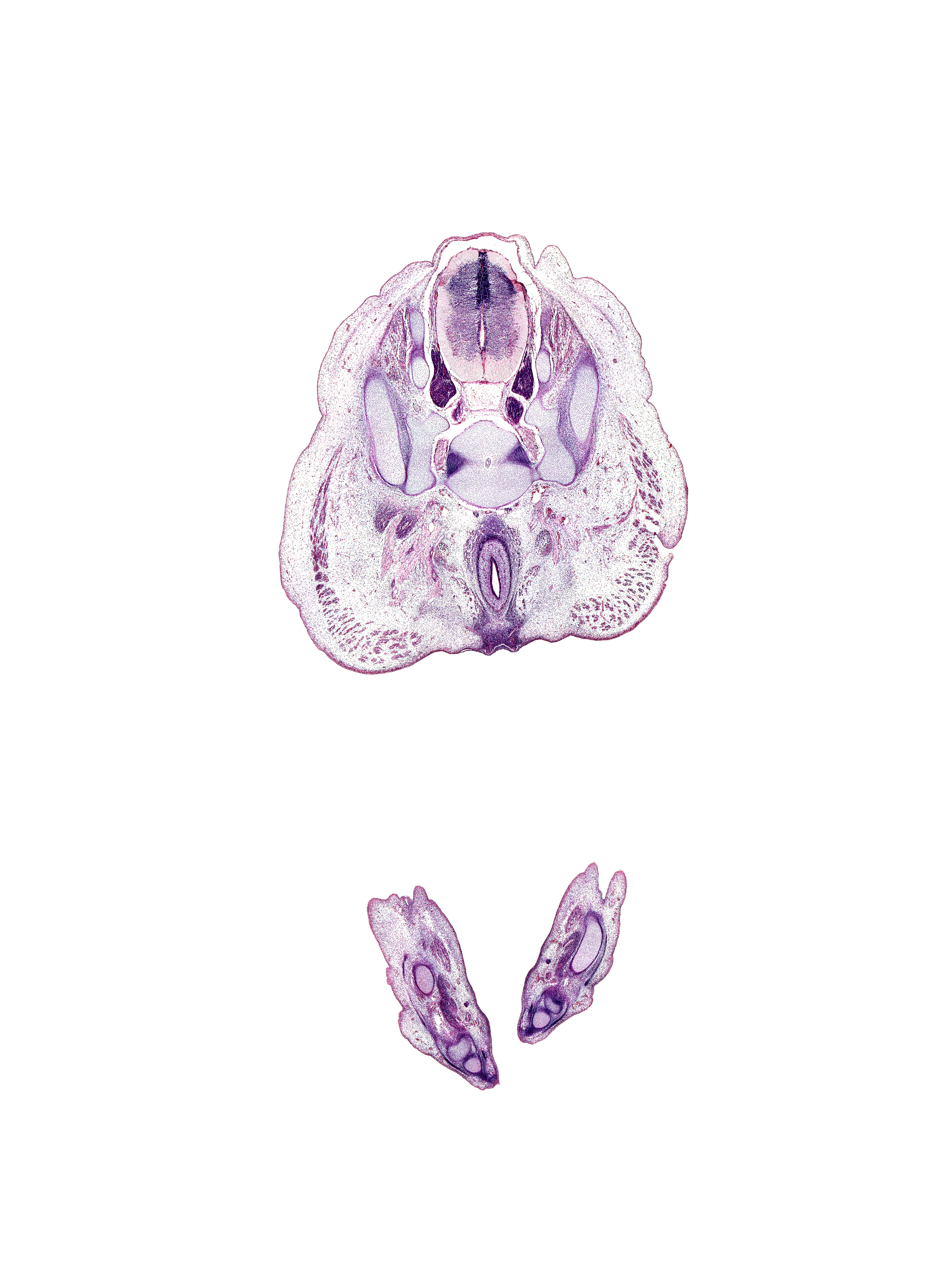 S-1 dorsal root, S-1 spinal ganglion, S-2 / S-3 intervertebral region, S-2 spinal ganglion, S-2 ventral primary ramus, anal pit, anal sphincter, artifact(s), cuboid, extensor digitorum longus tendon, flexor digitorum longus tendon, gluteus maximus muscle, ilium, levator ani muscle, metatarsal 4, notochord, osteogenic layer, plantar interosseus muscle, rectum lumen, sacro-iliac joint