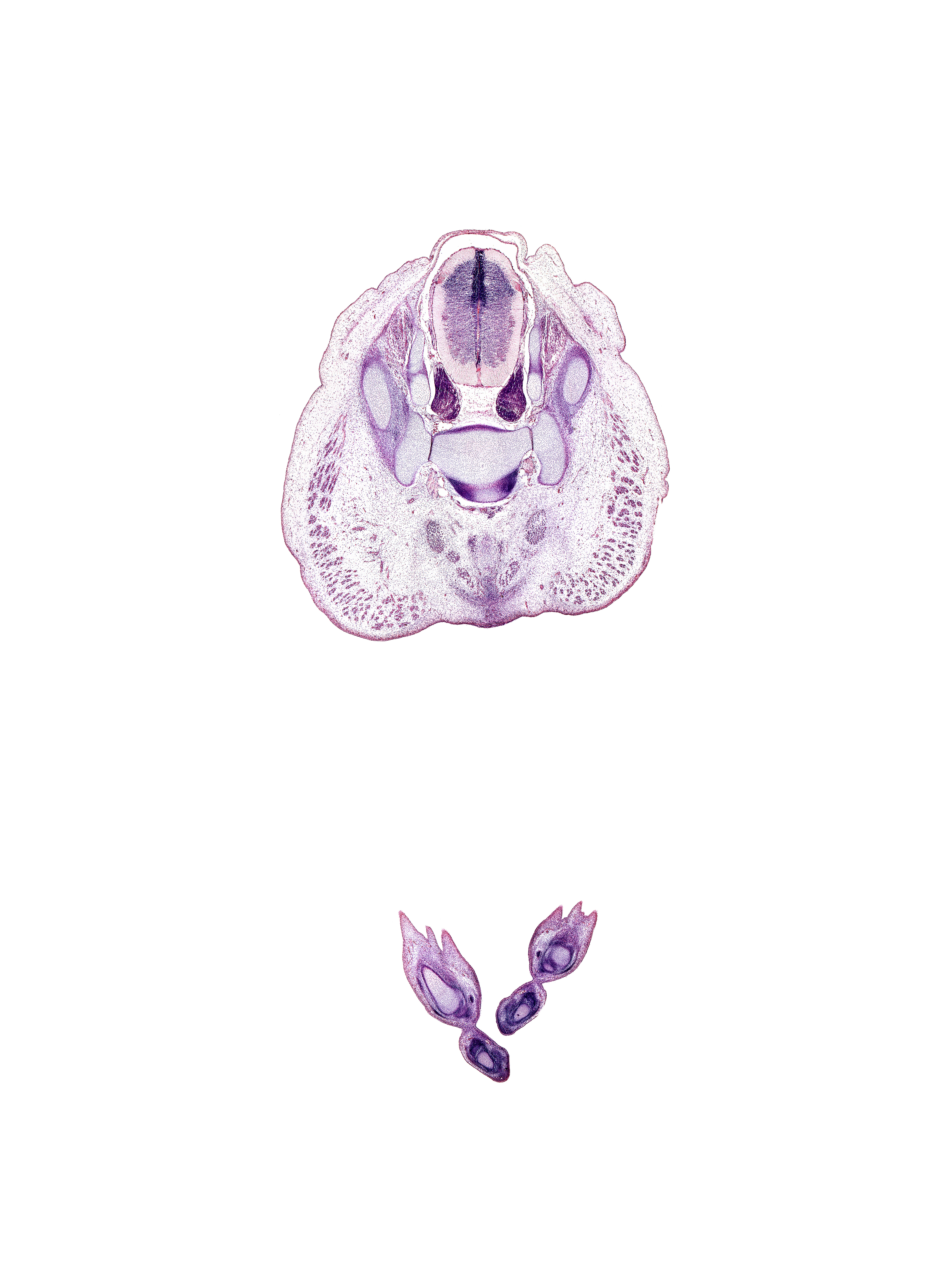 S-2 spinal ganglion, S-3 / S-4 intervertebral region, S-3 ventral primary ramus, caudal eminence, coccygeus muscle, fibularis brevis tendon, gluteus maximus muscle, ilium, levator ani muscle, metatarsal 5, metatarsal 5 head, neural arch, subarachnoid space, tuberosity