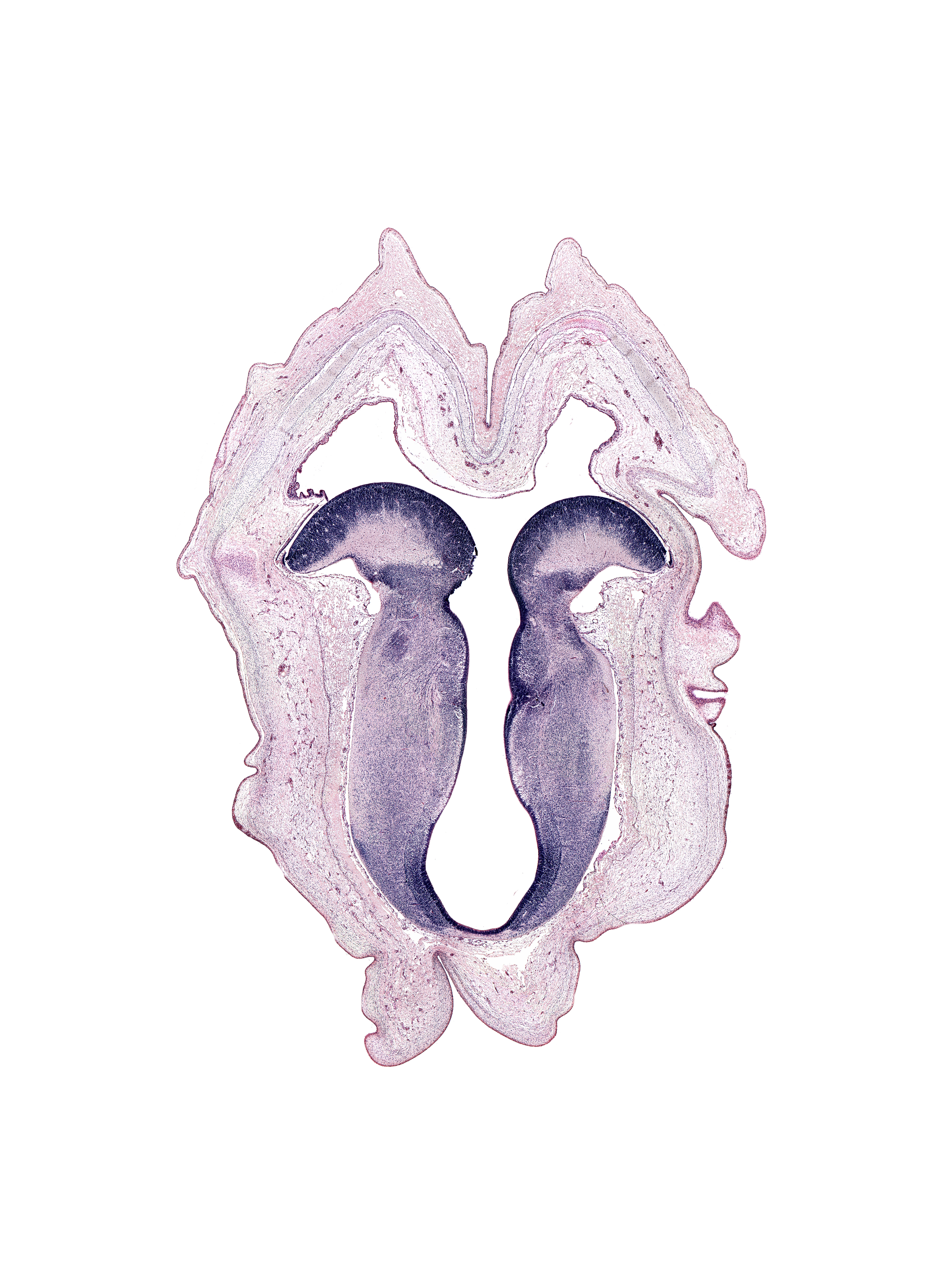 alar plate(s), basal plate, cerebral aqueduct (mesocoele), oculomotor nerve tract, oculomotor nucleus, rhombencoel (fourth ventricle), sulcus limitans, trochlear nucleus, vascular plexus, vestibular area