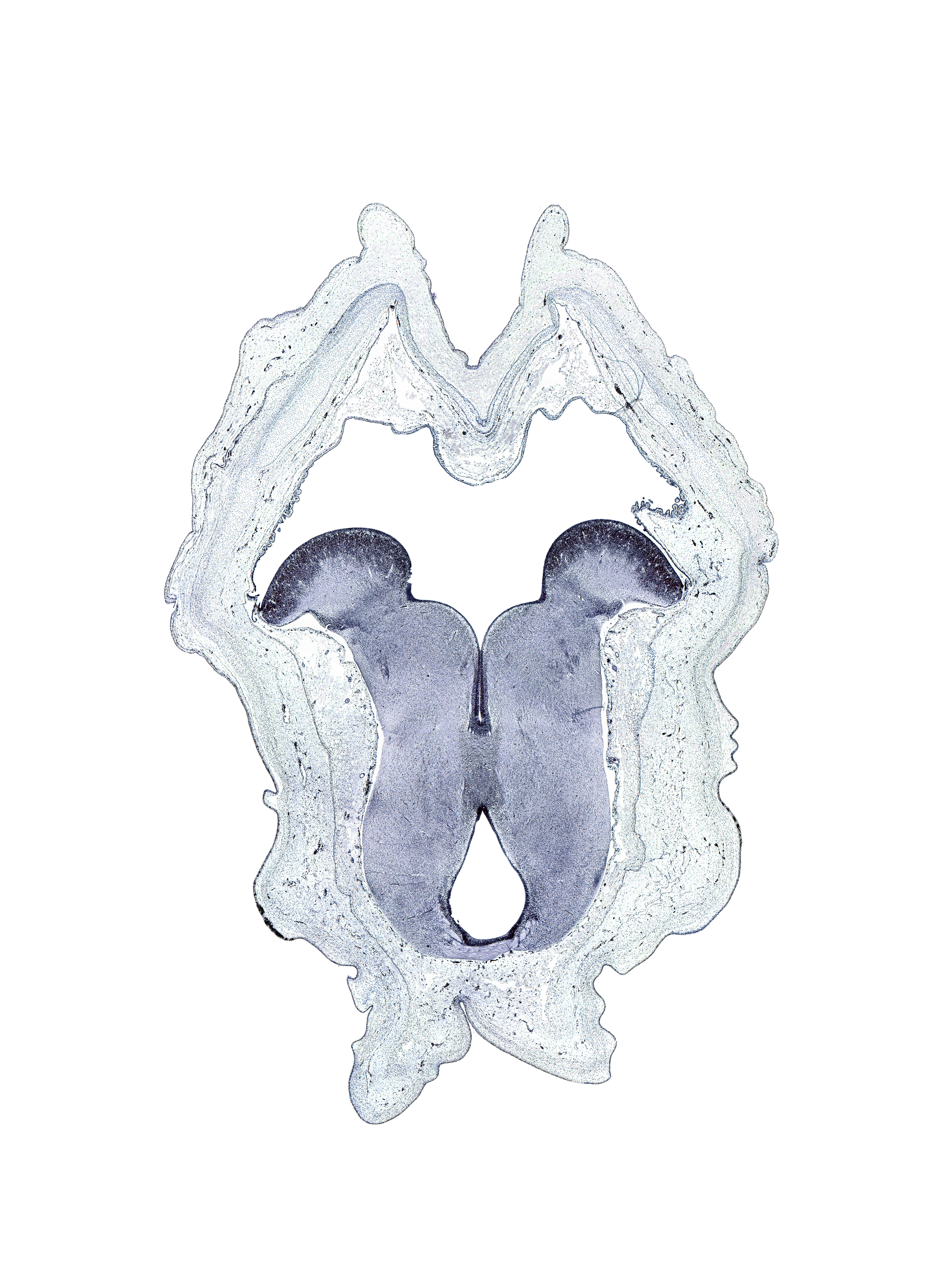 abducens nucleus, basis pedunculi of pons region (metencephalon), interpeduncular nucleus, medullary vellum, posterior commissure, red nucleus, sulcus limitans