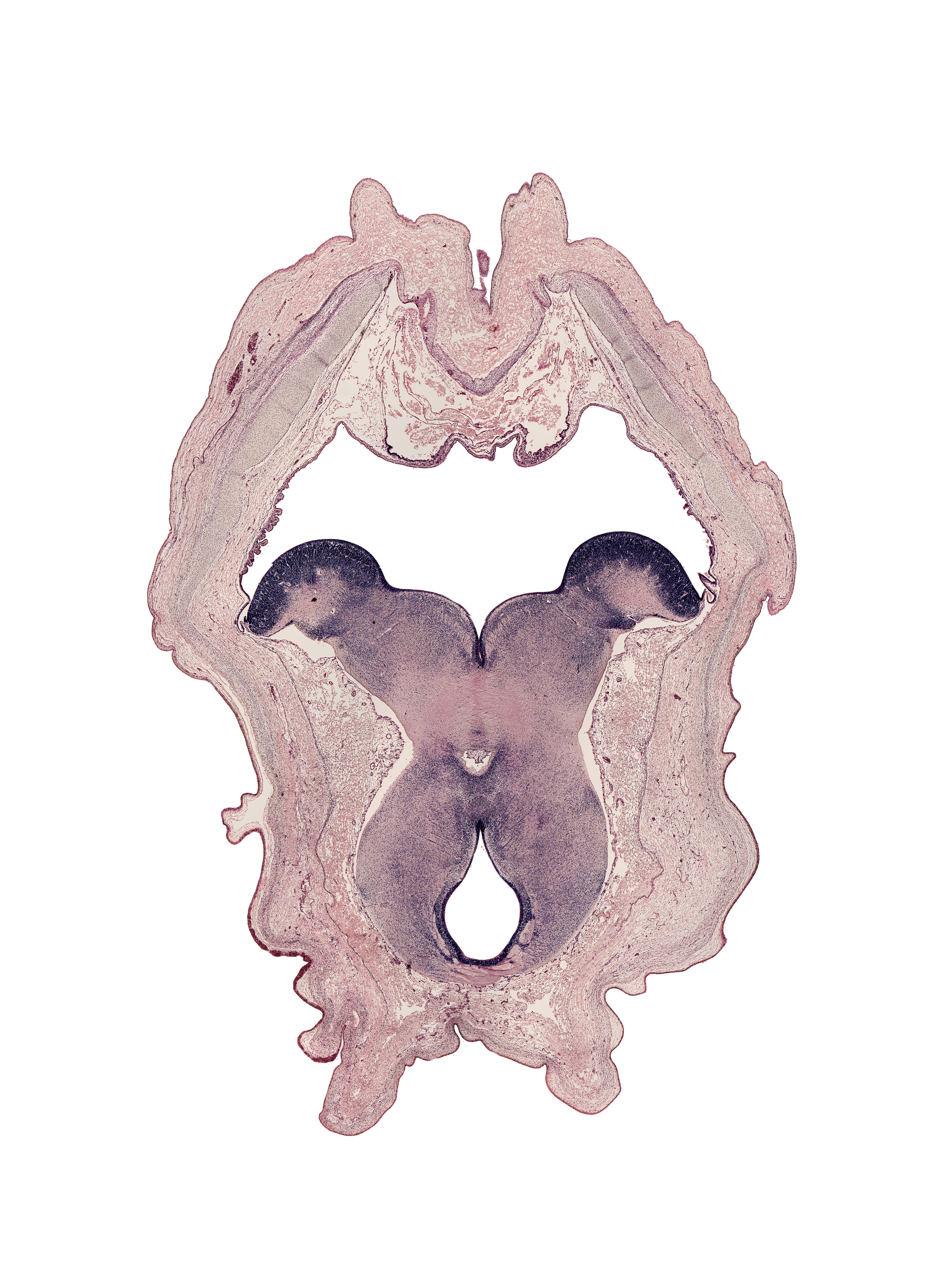 alar plate of metencephalon (cerebellum), alar plate(s), basal plate, basis pedunculi of pons region (metencephalon), caudal part of third ventricle, diencephalon, facial nerve genu, floor plate, interpeduncular fossa, interpeduncular nucleus, metencephalon, oculomotor nerve tract, posterior commissure, rhombencoel (fourth ventricle), roof plate, sulcus limitans, tegmentum of mesencephalon