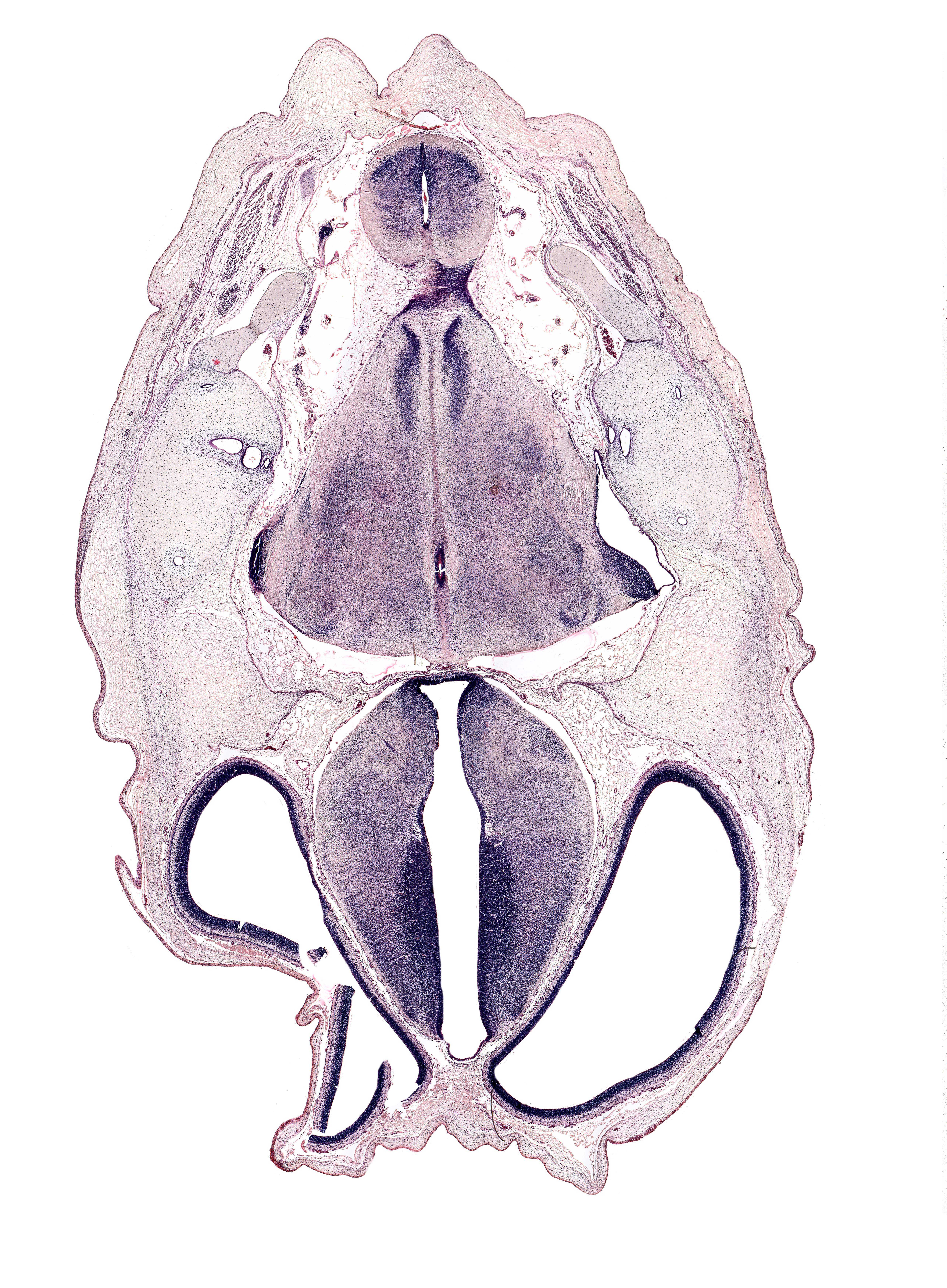 anterior semicircular duct, artifact fracture(s), artifact space(s), common crus, dorsal thalamus, dural band for tentorium cerebelli, dural limiting membrane, endolymphatic duct, exoccipital, facial nerve tract, hypothalamus, lateral ventricle, medial accessory olivary nucleus, medial longitudinal fasciculus, median sulcus in floor of rhombencoel (fourth ventricle), otic capsule cartilage, posterior dural venous plexus, posterior semicircular duct, roof plate, spinal tract of trigeminal nerve (CN V), subarachnoid space, third ventricle, ventral thalamus, zona limitans intrathalamica