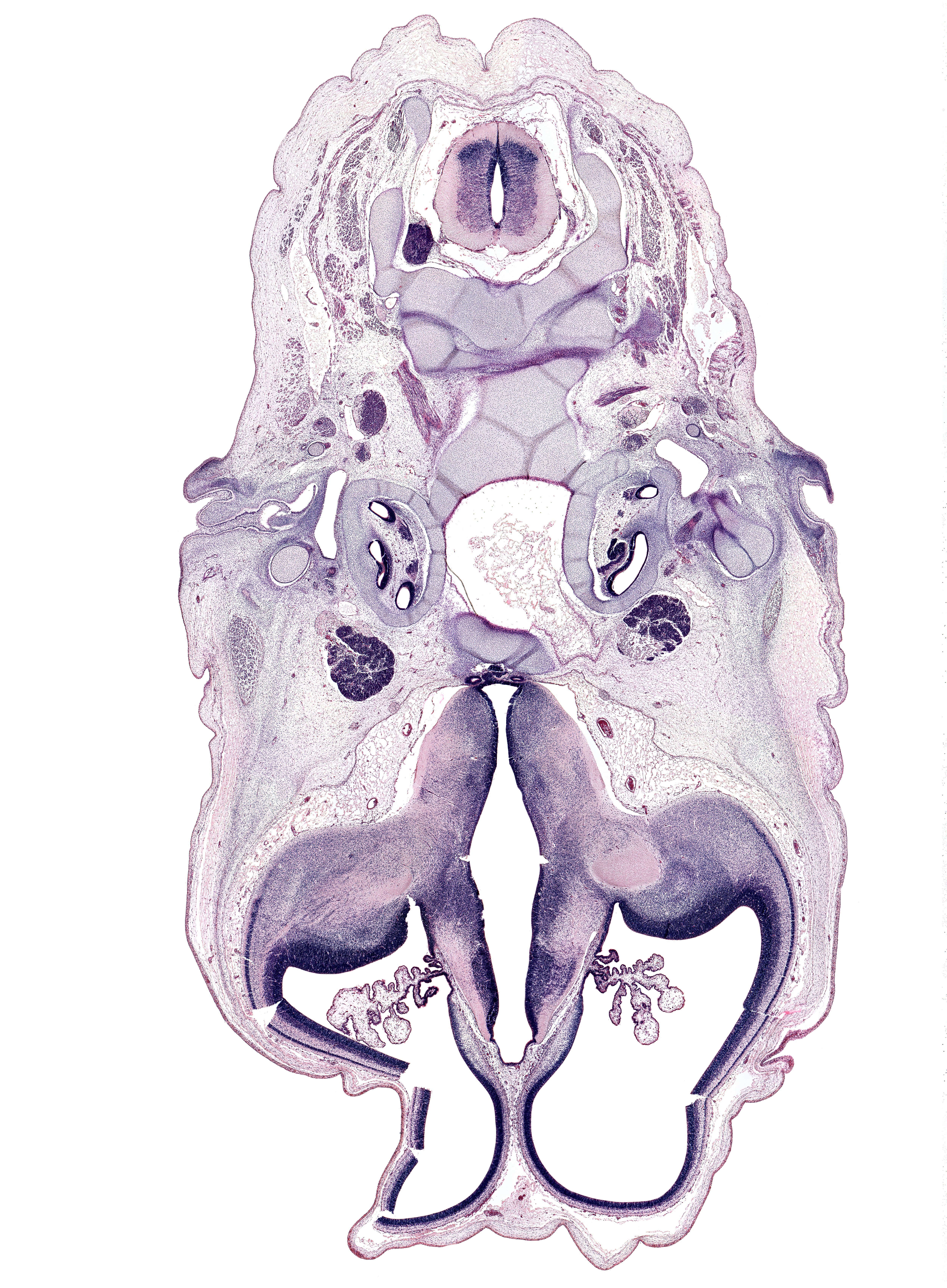 C-2 / C-3 interganglion region, abducens nerve (CN VI), artifact fracture(s), atlanto-axial joint, atlanto-occipital joint, auricle, central canal, choroid plexus, cochlear duct, dorsum sellae, hippocampus, hypothalamus, internal capsule, lateral ventricle, longissimus muscle, mandibular nerve (CN V₃), neurohypophysis, oculomotor nerve (CN III), pharyngeal arch 2 cartilage, posterior arch of C-2 vertebra (axis), posterior communicating artery, semispinalis capitis muscle, semispinalis cervicis muscle, spiral ganglion (CN VIII), splenius muscle, sternocleidomastoid muscle, subarachnoid space, transverse foramen, trapezius muscle, trigeminal ganglion (CN V), trochlear nerve (CN IV), tuberal part of adenohypophysis