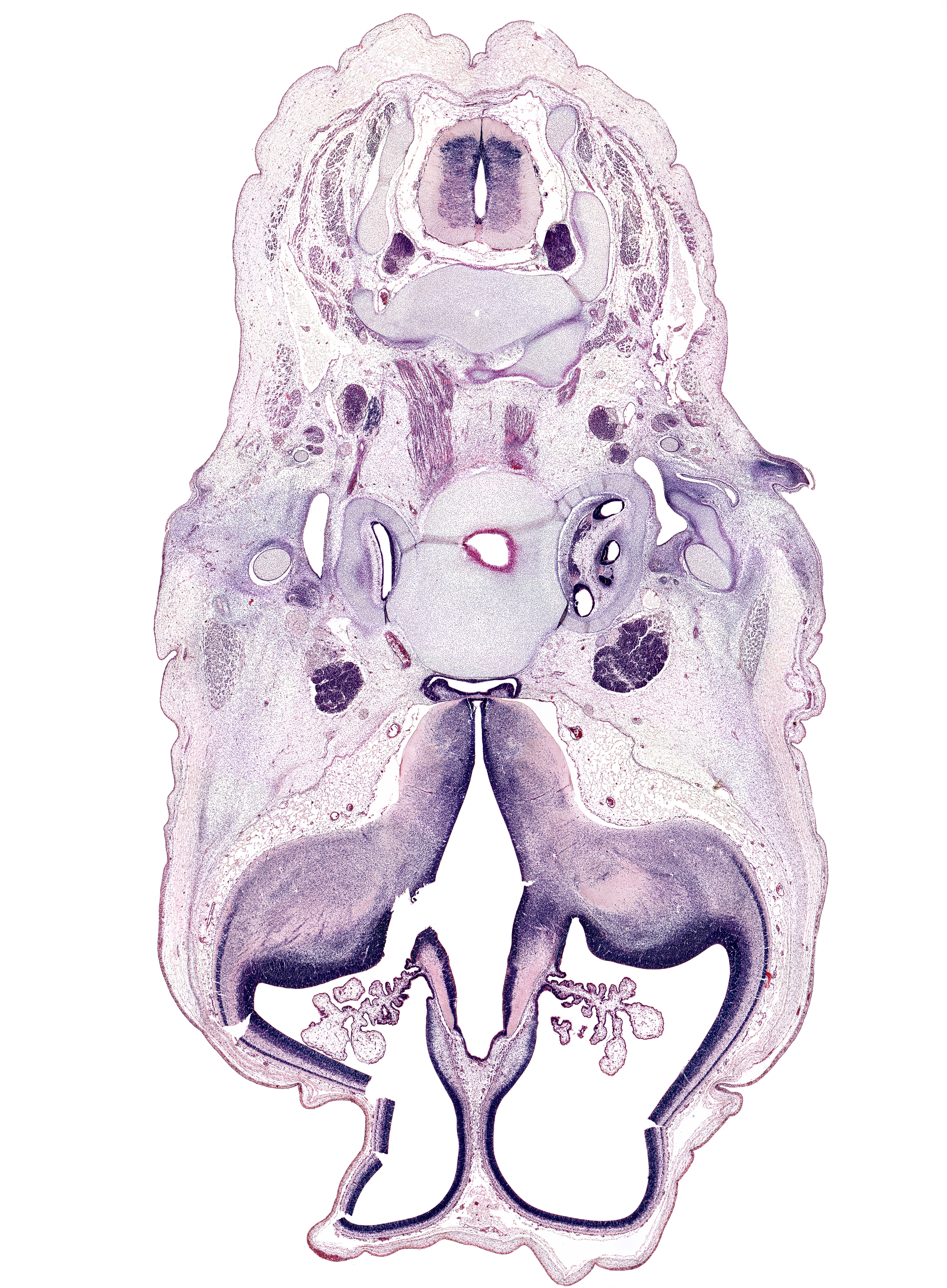 C-3 spinal ganglion, adenohypophysis, artifact(s), auricle, basi-occipital (basal plate), body of sphenoid, centrum of C-2 vertebra (axis), cephalic edge of pharynx, choroid plexus, cochlear duct, cortical plate, habenular commissure, inferior ganglion of glossopharyngeal nerve (CN IX), inferior ganglion of vagus nerve (CN X), internal capsule, internal carotid artery, interventricular foramen, lateral mass of C-1 vertebra (atlas), lateral ventricular eminence (telencephalon), longus capitis muscle, motor root of trigeminal nerve (CN V), neural arch of C-3 vertebra, optic tract, otic capsule, pharyngeal arch 2 cartilage, posterior communicating artery, residual lumen, spinal accessory nerve (CN XI), subarachnoid space, temporalis muscle, tympanic cavity