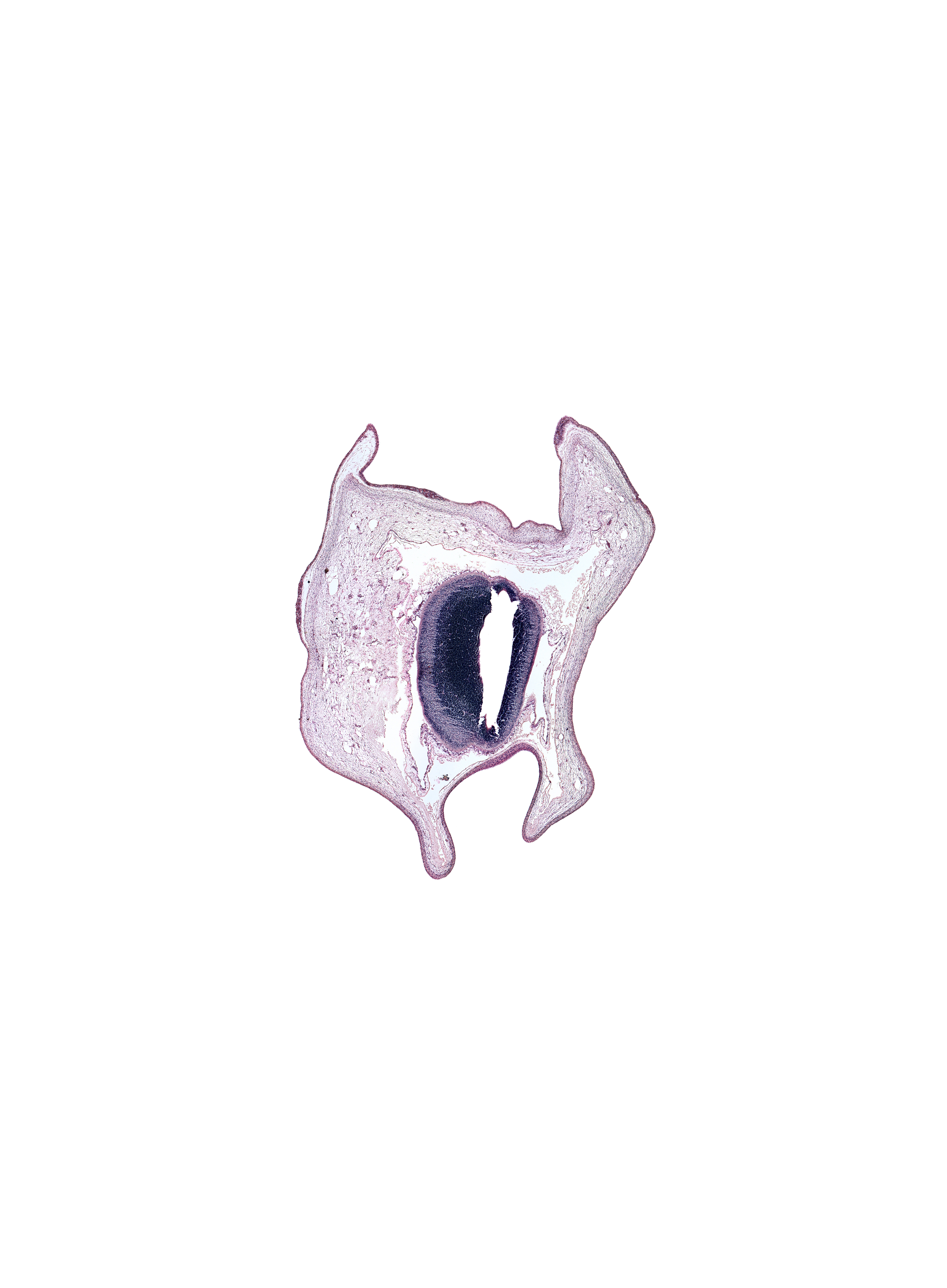 alar plate of mesencephalon, artifact fracture(s), cerebral aqueduct (mesocoele), head mesenchyme, roof plate