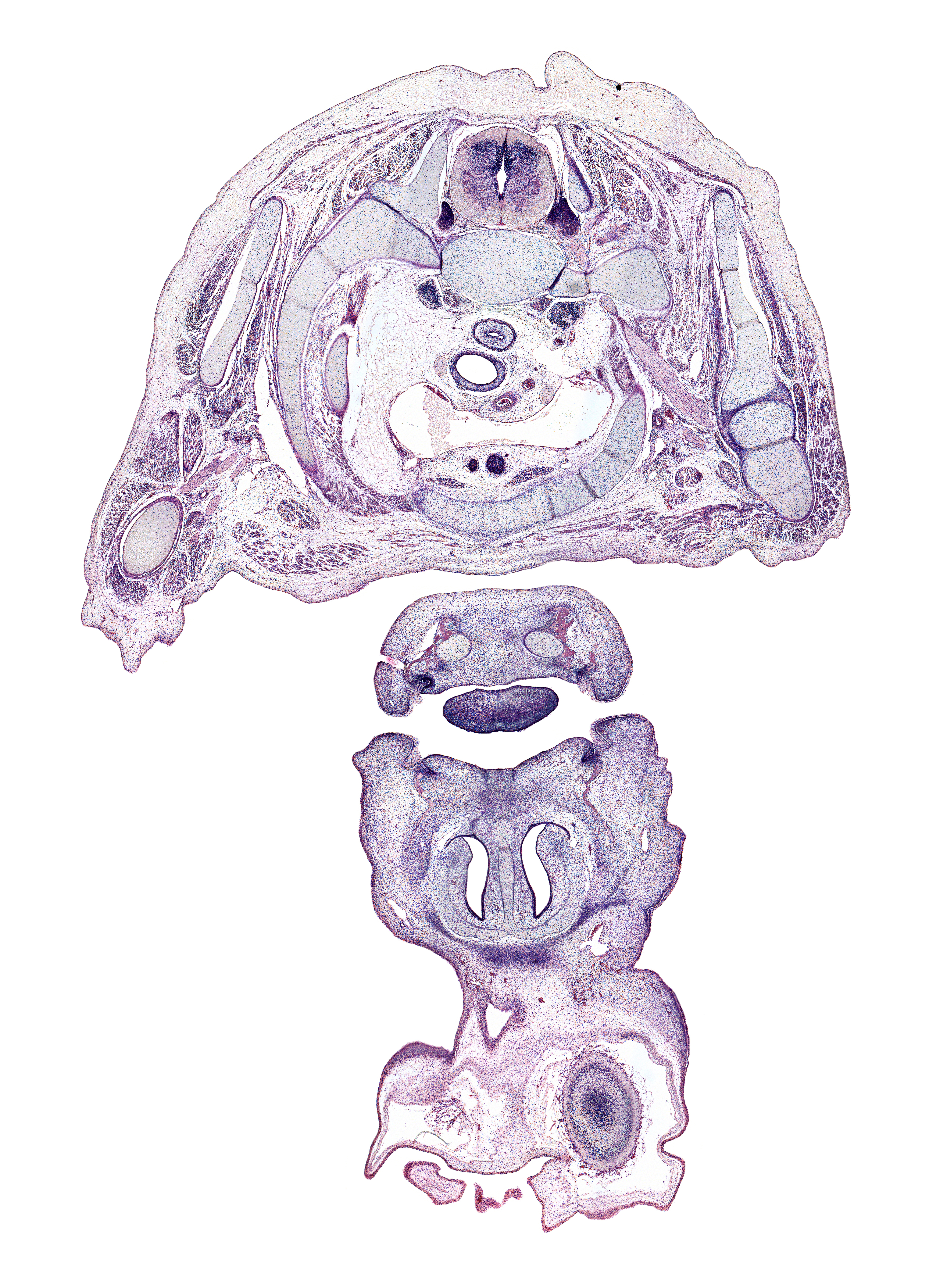 T-1 dorsal primary ramus, T-1 spinal ganglion, T-1 spinal nerve, anterior scalene muscle, artifact fracture(s), axillary artery, brachial plexus cords, brachiocephalic artery, centrum of T-1 vertebra, edge of frontal prominence, frontal edge of cerebral vesicle (hemisphere), inferior cervical sympathetic ganglion, interorbital ligament, lateral head of triceps brachii muscle, left brachiocephalic vein, left common carotid artery, left subclavian artery, long head of triceps brachii muscle, lower lip, nasal capsule cartilage, nasal cavity (nasal sac), neural arch, oral cavity, primary palate, radial nerve, rib 1, subarachnoid space, upper lip, vagus nerve (CN X), vascular plexus