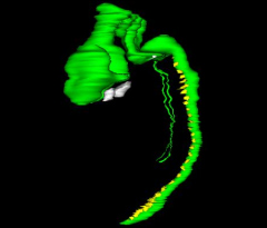 Nervous System