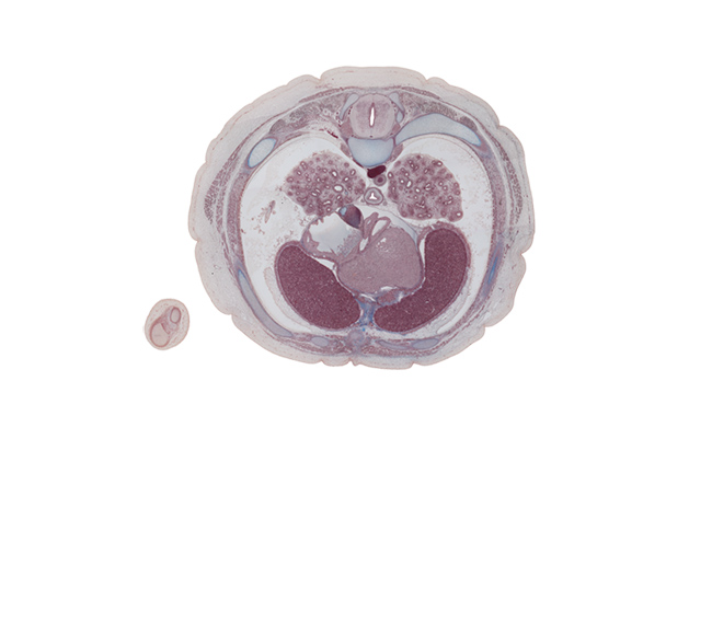 T-6 spinal ganglion, anastomosis between azygos and hemi-azygos veins, aorta, atrioventricular sulcus, caudal edge of left atrium, caudal edge of middle lobe of right lung, centrum of T-7 vertebra, costodiaphragmatic recess, iliocostalis muscle, inferior vena cava, interventricular sulcus, left vagus nerve (CN X), longissimus muscle, loose connective tissue, lower lobe of right lung, pericardial cavity, rectus abdominis muscle, rib 7, right atrium, spinalis muscle, subcutaneous tissue, xiphoid