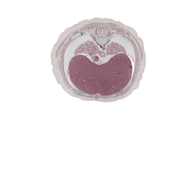 T-7 spinal ganglion, aorta, azygos vein, caudal part of pericardial cavity, central canal, central tendon of diaphragm, diaphragm, dorsal median septum, esophagus, inferior hemi-azygos vein, inferior vena cava, left lobe of liver, neural arch, posterior intercostal vein, right lobe of liver, spinal cord, transverse process, tubercle of rib 8