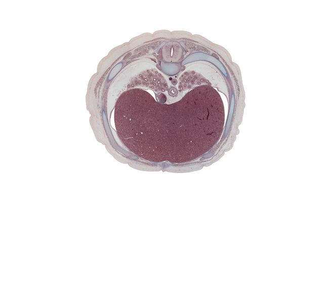 T-7 spinal ganglion, aorta, azygos vein, central canal, central tendon of diaphragm, costal margin, esophagus, inferior hemi-azygos vein, inferior vena cava, latissimus dorsi muscle, left lobe of liver, linea alba, rectus abdominis muscle, rib 8, right lobe of liver, spinal cord, subcostal muscle, trapezius muscle