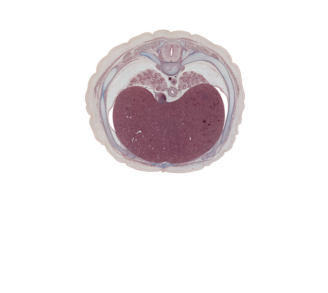 T-7 / T-8 interganglion region, T-7 / T-8 intervertebral disc, anterior spinal artery, central tendon of diaphragm, costal margin, costotransverse joint, diaphragm, inferior vena cava, left lobe of liver, left vagus nerve (CN X), lower lobe of left lung, lower lobe of right lung, notochord, peritoneal cavity, pleural cavity, rib 8, right lobe of liver, right vagus nerve (CN X), sympathetic trunk