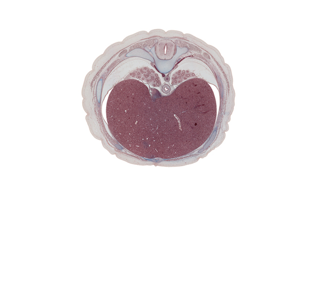 T-8 spinal ganglion, aorta, azygos vein, costal margin, esophagus, inferior vena cava, left lobe of liver, linea alba, lower lobe of left lung, lower lobe of right lung, posterior intercostal artery, posterior intercostal vein, posterior spinal artery, rectus abdominis muscle, rib 8, right lobe of liver, right phrenic nerve, tributary of left hepatic vein