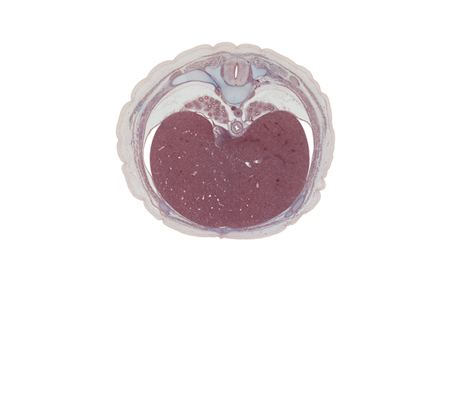 T-8 spinal ganglion, anterior gastric nerve (CN X), anterior rectus sheath, common hepatic vein, costal margin, esophagus, external intercostal muscle(s), iliocostalis muscle, inferior vena cava, innermost intercostal muscle(s), internal intercostal muscle(s), left lobe of liver, longissimus muscle, posterior gastric nerve (CN X), pulmonary ligament, rectus abdominis muscle, right lobe of liver, spinalis muscle, transverse process, transversospinalis muscle, trapezius muscle, tributaries of left hepatic vein