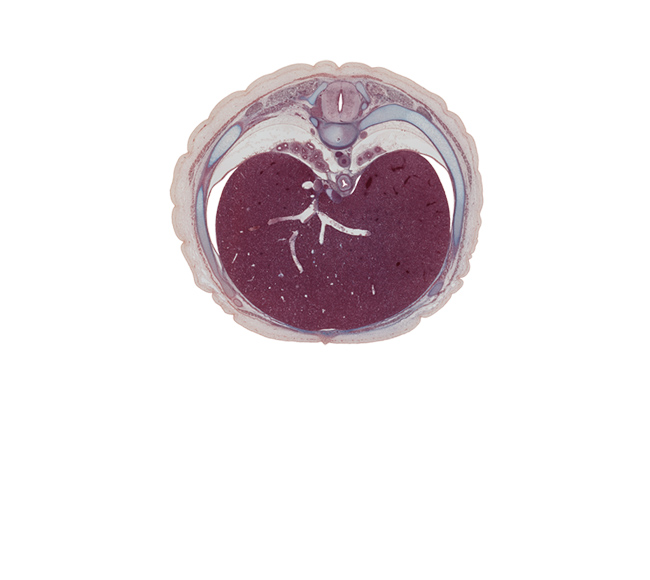 T-8 / T-9 intervertebral disc, T-8 spinal ganglion, aorta, azygos vein, costal margin, ductus venosus, efferent hepatic vein, esophageal nerve plexus, esophagus, inferior vena cava, intermediate hepatic vein, latissimus dorsi muscle, left hepatic vein, left lobe of liver, linea alba, neural arch, normal spina bifida occulta, notochord, ramus of greater splanchnic nerve, rib 9, right hepatic vein, right lobe of liver, trapezius muscle, tributary of right hepatic vein