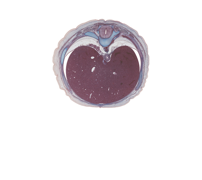 T-9 rib, T-9 spinal ganglion, anastomosis between azygos and hemi-azygos veins, aorta, costal margin, diaphragm, dorsal meso-esophagus, ductus venosus, efferent hepatic vein, inferior vena cava, left lobe of liver, linea alba, lower lobe of right lung, parietal pleura, peritoneal cavity, ramus of greater splanchnic nerve, rectus abdominis muscle, right lobe of liver, sympathetic trunk