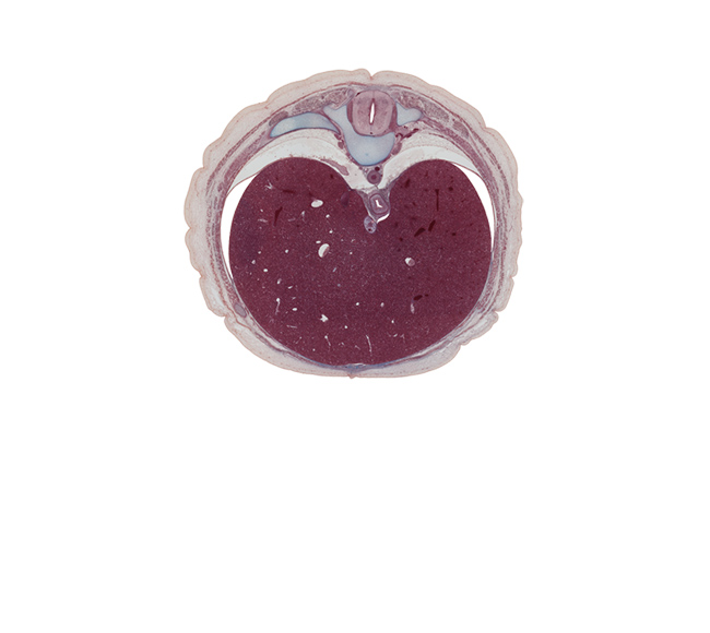 T-9 spinal ganglion, T-9 spinal nerve, aorta, centrum of T-9 vertebra, diaphragm, dorsal meso-esophagus, ductus venosus, efferent hepatic vein, inferior vena cava, latissimus dorsi muscle, left lobe of liver, lung, right, parietal pleura, peritoneal cavity, pleural recess, right lobe of liver, sympathetic trunk, thoracolumbar fascia, trapezius muscle