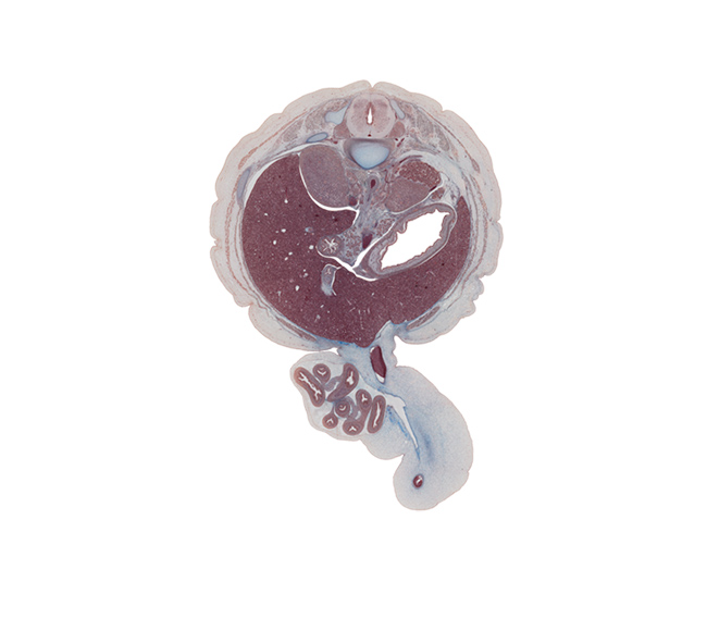 T-12 / L-1 intervertebral disc, T-12 spinal ganglion, aorta, body of dorsal pancreas, cephalic edge of gall bladder, cystic duct, descending part of duodenum, edge of left umbilical artery, extension of umbilical coelom, head of ventral pancreas, herniated intestines, inferior vena cava, left lobe of liver, origin of superior mesenteric artery, quadrate lobe of liver, right lobe of liver, superior mesenteric vein, superior pole of kidney (metanephros), sympathetic trunk, tail of dorsal pancreas, umbilical coelom, umbilical vein