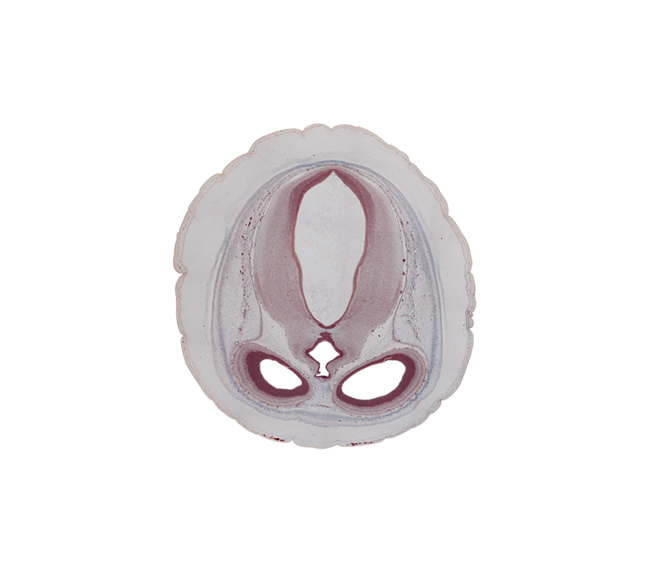 cerebral aqueduct (mesocoele), cortical plate, dural limiting membrane, habenular region, hypothalamic sulcus, intermediate zone, lateral ventricle, marginal zone, mesencephalic arteries in pia mater, mesencephalon, osteogenic layer, superior colliculus region, superior sagittal sinus, third ventricle, venous plexus(es), ventricular zone