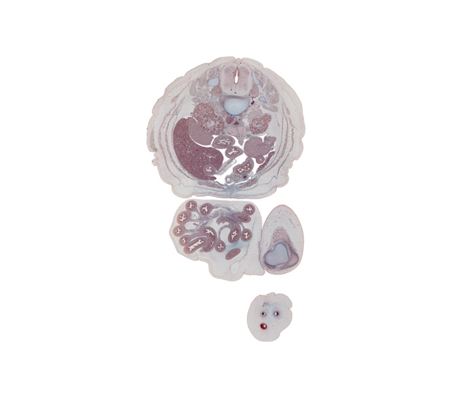 L-2 / L-3 intervertebral disc, L-2 spinal ganglion, aortic bifurcation, colon, epididymis, fundus of urinary bladder, herniated intestines, horizontal part of duodenum, inferior mesenteric artery, inferior mesenteric ganglion, inferior vena cava, jejunum, left lobe of liver, left umbilical artery, medial condyle of femur, minor calyx, notochord, patella, quadratus lumborum muscle, quadriceps femoris muscle, quadriceps femoris tendon, right lobe of liver, right umbilical artery, sympathetic trunk, testis, umbilical cord, umbilical vein, umbilical vesicle stalk, ureter, vas deferens