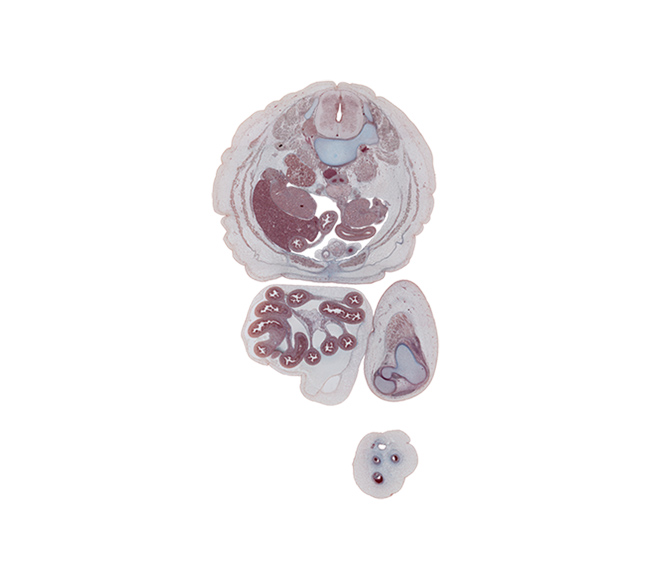 L-2 / L-3 interganglion region, allantoic vesicle(s), anterior rectus sheath, colon, fundus of urinary bladder, hypogastric ganglion, iliocostalis muscle, inferior vena cava, left common iliac artery, left umbilical artery, longissimus muscle, medial condyle of tibia, mesentery, posterior rectus sheath, quadratus lumborum muscle, quadriceps femoris muscle, rectus abdominis muscle, right common iliac artery, right testis, right umbilical artery, superior mesenteric vessels, sympathetic trunk, testis, tibia, transversospinalis muscle, umbilical vein, umbilical vesicle stalk, vas deferens