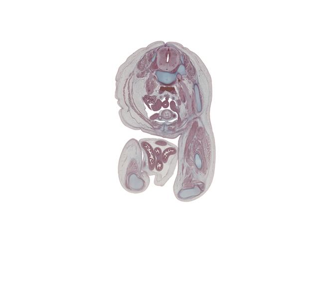 L-3 / L-4 interganglion region, adductor magnus muscle, caudal edge of jejunum loop, caudal edge of testis, external abdominal oblique muscle, femoral nerve, femur, great saphenous vein, gubernaculum of testis, head of fibula, herniated intestines, inferior epigastric artery, inguinal canal, internal abdominal oblique muscle, junction of common iliac veins, lateral condyle of tibia, medial condyle of tibia, rectus femoris muscle, sartorius muscle, semimembranosus muscle, semitendinosus tendon, superficial inguinal ring, symphysis of pubis, transversus abdominis muscle, umbilical coelom, umbilical cord, ureter, urinary bladder lumen, vas deferens, vastus intermedius muscle, vastus lateralis muscle