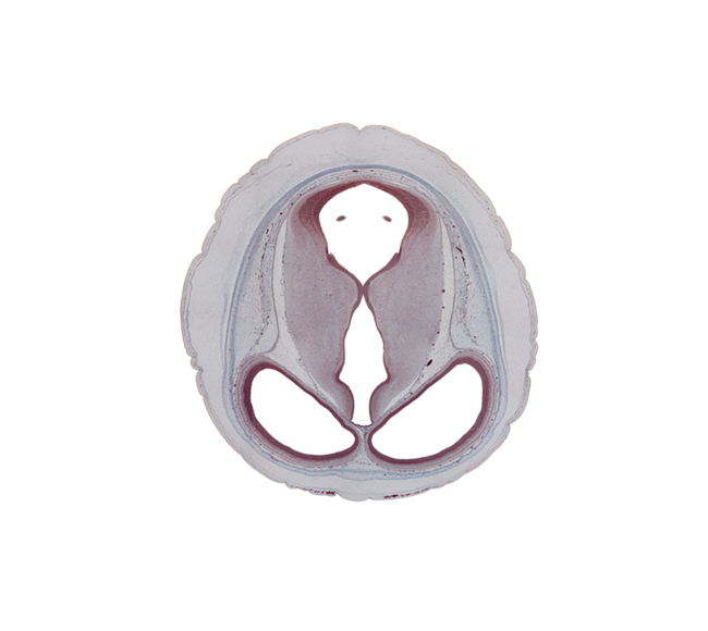cerebral aqueduct (mesocoele), diencephalon, lateral ventricle, loose connective tissue, mesencephalon (tectum), mesencephalon (tegmentum), ossifying occipital tectum, osteogenic layer, pericranium, roof of third ventricle, sulcus dorsalis, sulcus medius, surface ectoderm, telencephalon, third ventricle