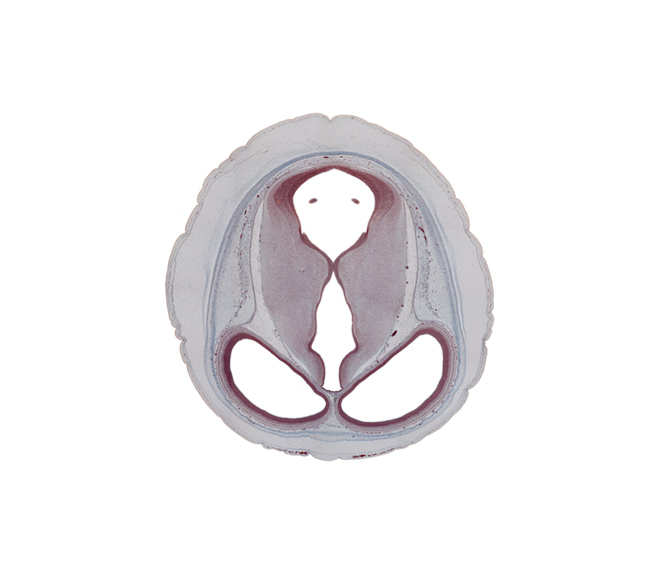 cerebral aqueduct (mesocoele), diencephalon, lateral ventricle, loose connective tissue, mesencephalon (tectum), mesencephalon (tegmentum), ossifying occipital tectum, osteogenic layer, pericranium, roof of third ventricle, sulcus dorsalis, sulcus medius, surface ectoderm, telencephalon, third ventricle