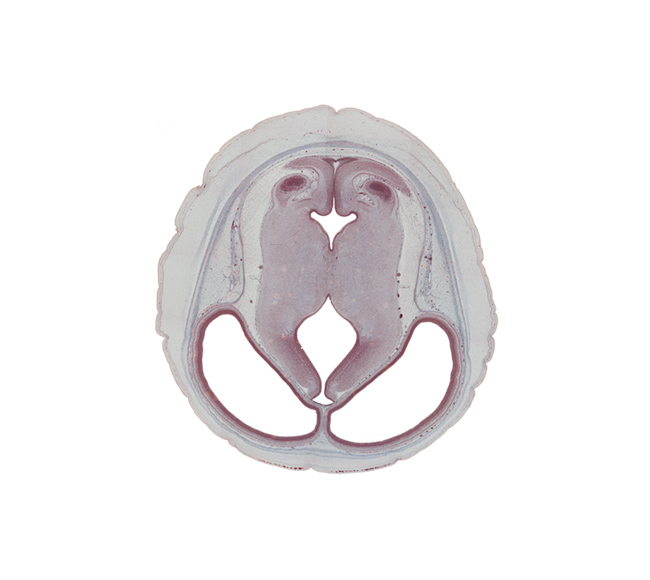 basis pedunculi of pons region (metencephalon), caudal edge of inferior colliculus, caudal part of cerebral aqueduct, cephalic part of cerebellum, cephalic part of rhombencoel (fourth ventricle), diencephalic artery, dorsal thalamus, hypothalamic sulcus, isthmus of rhombencephalon, lateral ventricle, median sulcus, mesencephalic artery, mesencephalon, root of trochlear nerve (CN IV), sensory decussation, subcutaneous vascular plexus, sulcus dorsalis, sulcus limitans, ventral thalamus