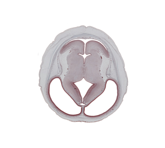 alar plate(s), cerebral hemisphere, dorsal thalamus, dural venous sinus, external germinal area, flocculus of cerebellum, hypothalamic sulcus, isthmus of rhombencephalon, lateral ventricle, median sulcus, membrane area of roof of rhombencoel (fourth ventricle), parietal lobe region, rhombencoel (fourth ventricle), roof of diencephalon, sensory decussation, subarachnoid space, subcutaneous tissue, sulcus dorsalis, third ventricle