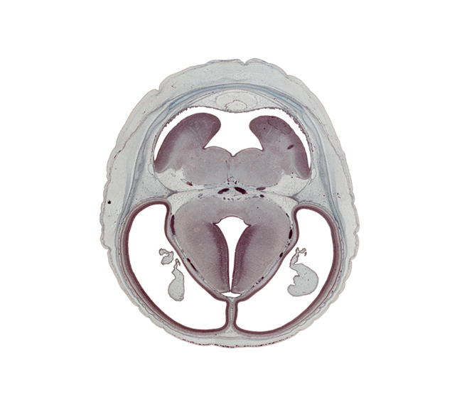 alar plate(s), basal plate, choroid plexus, cortical plate, diverticulum, dorsal thalamus, hypothalamic sulcus, intraventricular cerebellum, lateral ventricle, median sulcus, oculomotor nerve (CN III), pons region (metencephalon), posterior cerebral artery, roof of rhombencoel (fourth ventricle), subarachnoid space, sulcus dorsalis, sulcus limitans, superior cerebellar artery, superior sagittal sinus, third ventricle, trochlear nerve (CN IV), ventral thalamus