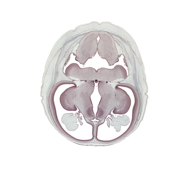 alar plate(s), anterior inferior cerebellar artery, basilar artery, choroid plexus, dorsal thalamus, hypothalamic sulcus, hypothalamus, inferior horn of lateral ventricle, internal capsule, lateral recess of rhombencoel (fourth ventricle), marginal ridge, obex, posterior communicating artery, posterior inferior cerebellar artery, rhombencoel (fourth ventricle), sulcus dorsalis, sulcus medius, third ventricle, ventral thalamus, zona limitans intrathalamica