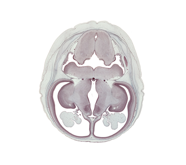 basal plate, basilar artery, central canal, cephalic edge of endolymphatic sac, cerebral arteries in pia mater, choroid plexus, dorsal thalamus, dural band for tentorium cerebelli, fusion region with anterior choroidal artery, hypoglossal nucleus, hypothalamus, internal capsule, median sulcus, medulla oblongata, neopallial cortex, posterior communicating artery, roof of third ventricle, striatothalamic fibers, subthalamus, sulcus dorsalis, sulcus limitans, sulcus medius, transverse sinus, ventral thalamus