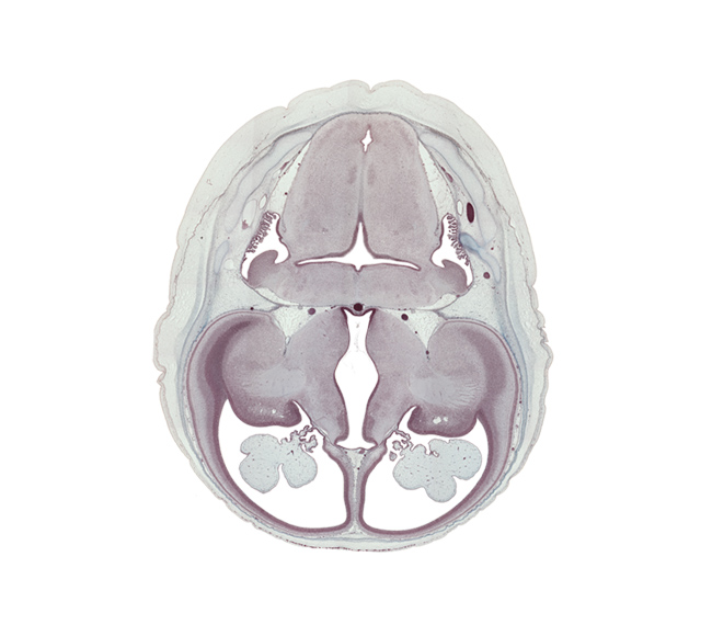 basilar artery, caudate nucleus, cephalic edge of dorsal thalamus, choroid plexus, cortical plate, edge of otic capsule, endolymphatic sac, fusion region with anterior choroidal artery, internal capsule, lateral recess of rhombencoel (fourth ventricle), lateral ventricular eminence (telencephalon), medial ventricular eminence (diencephalon), oculomotor nerve (CN III), posterior communicating artery, rhombencoel (fourth ventricle), supra-occipital cartilage, tegmentum of pons, trochlear nerve (CN IV)