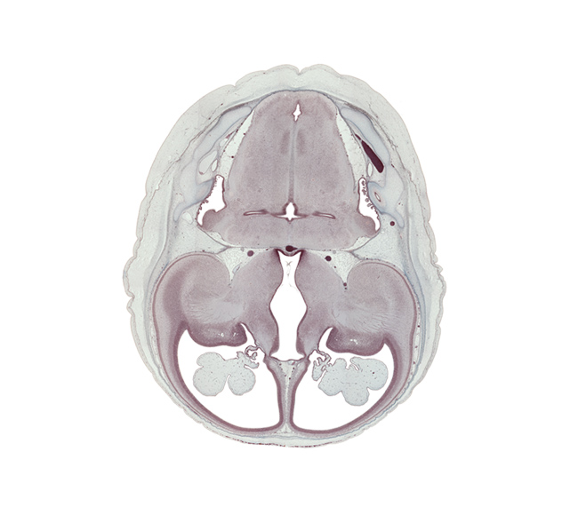 caudate nucleus, choroid fissure, choroid plexus, claustrum, dural band for tentorium cerebelli, endolymphatic sac, globus pallidus, hippocampus, hypothalamic sulcus, hypothalamus, internal capsule, lamina affixa, lateral recess of rhombencoel (fourth ventricle), lateral ventricle, lateral ventricular eminence (telencephalon), medial accessory olivary nucleus, medial ventricular eminence (diencephalon), putamen, rhombencoel (fourth ventricle), spinal tract of trigeminal nerve (CN V), sulcus terminalis, third ventricle, transverse sinus