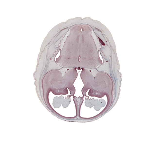 anterior choroidal artery, capsula extrema, caudate nucleus, claustrum, cortical plate, edge of anterior semicircular duct, edge of median sulcus in floor of rhombencoel (fourth ventricle), endolymphatic sac, external capsule, falx cerebri region, fasciculus cuneatus, fasciculus gracilis, globus pallidus, interventricular foramen, lateral recess of rhombencoel (fourth ventricle), medial accessory olivary nucleus, medial lemniscus, medulla oblongata, nucleus of spinal tract of trigeminal nerve, oculomotor nerve (CN III), petrous part of temporal bone (otic capsule), posterior communicating artery, putamen, sulcus terminalis, superior sagittal sinus, third ventricle, trochlear nerve (CN IV)