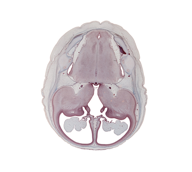 anterior inferior cerebellar artery, anterior semicircular duct, basilar artery, central canal, choroid fissure, edge of interventricular foramen, hypothalamic sulcus, hypothalamus, insula of cerebral hemisphere, lateral recess of rhombencoel (fourth ventricle), lateral ventricle, lateral ventricular eminence (telencephalon), medial accessory olivary nucleus, medial lemniscus, medial ventricular eminence (diencephalon), medulla oblongata, posterior communicating artery, posterior inferior cerebellar artery, sigmoid sinus, subarachnoid space, sulcus terminalis, third ventricle