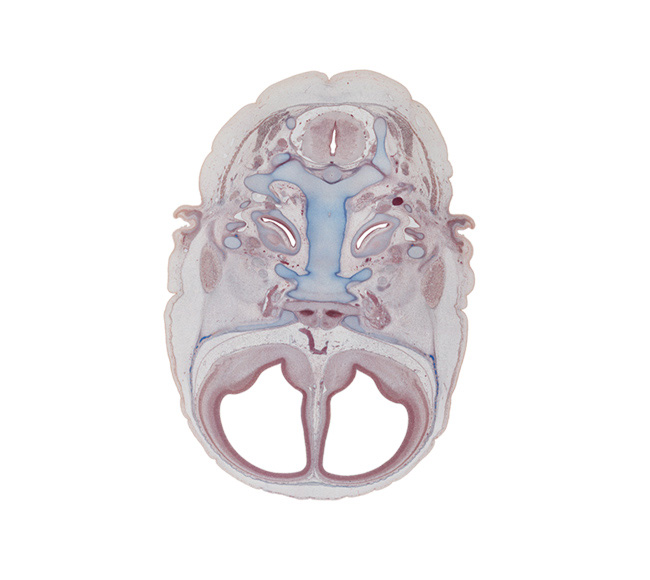 anterior communicating artery, atlanto-occipital joint, auricle, basi-occipital (basal plate), carotid canal, caudal part of cochlear duct, central canal, chorda tympani nerve, dens of C-2 vertebra (axis), greater wing of sphenoid, incus, internal carotid artery, malleus, mandibular nerve (CN V₃), maxillary nerve (CN V₂), neural arch of C-1 vertebra (atlas), notochord remnant, occipital condyle, ophthalmic nerve (CN V₁), optic canal, optic nerve (CN II), otic capsule, pre-optic area, spinal accessory nerve (CN XI), spinal cord, superior orbital fissure