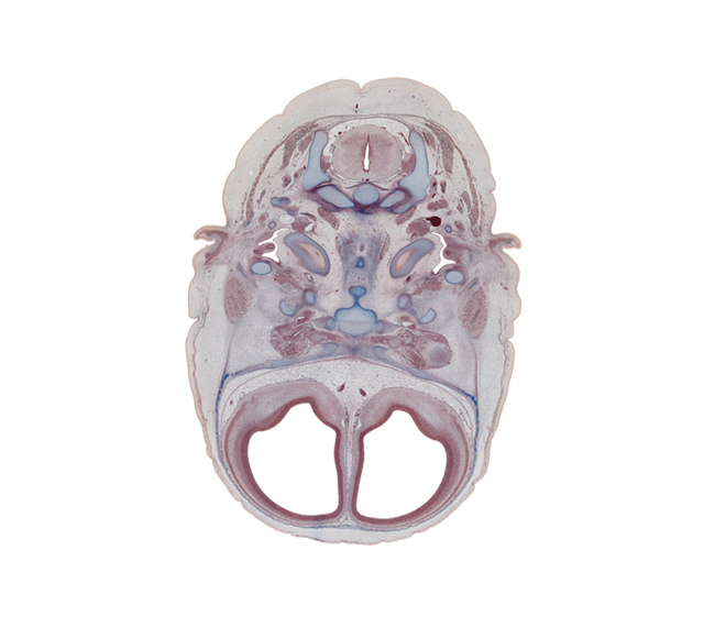 C-2 spinal ganglion, alar plate(s), anterior communicating artery, atlanto-occipital joint, basal plate, dens of C-2 vertebra (axis), edge of cochlea, edge of eyeball, extrinsic ocular muscle(s), floor plate, frontal bone ossification, lateral ventricular eminence (telencephalon), lesser wing of sphenoid, middle ear (tympanic) cavity, neural arch of C-1 vertebra (atlas), optic canal, optic nerve (CN II), optic nerve (CN II) with sheath, otic ganglion, petrous part of temporal bone (otic capsule), pharyngeal arch 2 cartilage, roof plate, sulcus limitans