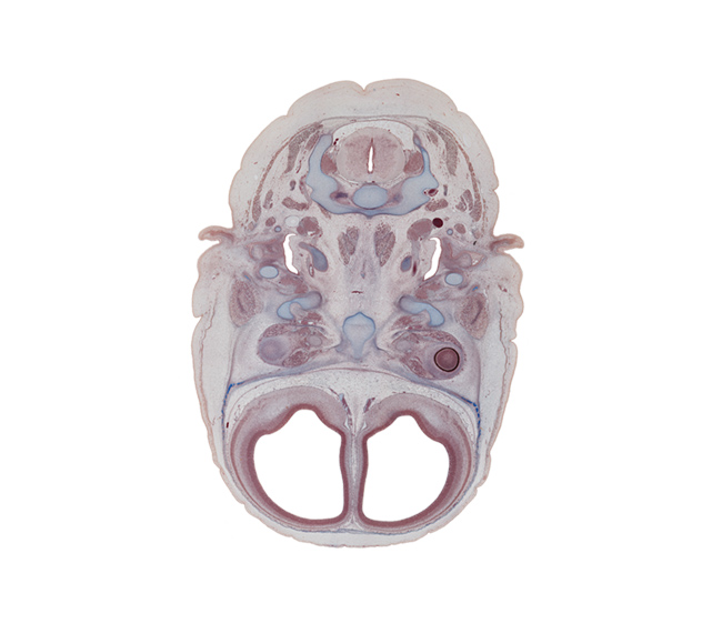 C-1 vertebra (atlas), C-2 spinal ganglion, anterior cerebral artery, ciliary ganglion, dens of C-2 vertebra (axis), edge of neural layer of retina, extrinsic ocular muscle(s), frontal bone ossification, inferior ganglion of vagus nerve (CN X), internal carotid artery, internal jugular vein, lateral ventricle, longus capitis muscle, middle ear (tympanic) cavity, semispinalis capitis muscle, sphenoid, splenius muscle, trapezius muscle, vertebral artery