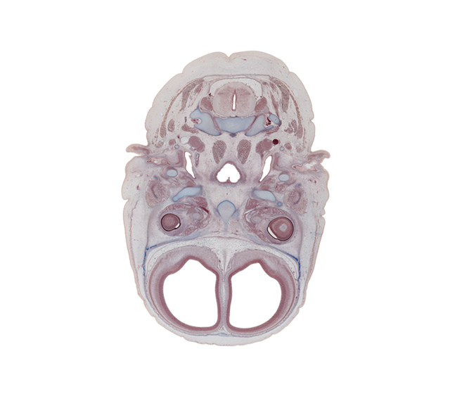 C-2 spinal ganglion, atlanto-axial joint, auricle, central canal, dural limiting membrane, edge of intraretinal space (optic vesicle cavity), edge of nasopharynx, ethmoid, external acoustic meatus, falx cerebri region, frontal bone ossification, internal carotid artery, jugular lymph sac, lateral rectus muscle, lateral ventricular eminence (telencephalon), middle ear (tympanic) cavity, posterior belly of digastric muscle, semispinalis capitis muscle, sphenoid, stylohyoid part of pharyngeal arch 2 cartilage, subarachnoid space, superior cervical sympathetic ganglion