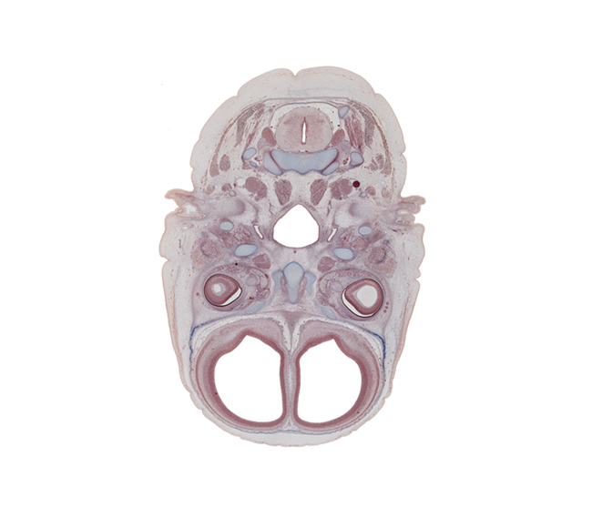 C-2 spinal ganglion, auricle, edge of nasal cavity (nasal sac), falx cerebri region, frontal bone, inferior ganglion of vagus nerve (CN X), intraretinal space (optic vesicle cavity), lateral rectus muscle, lateral ventricle, longus capitis muscle, medial pterygoid muscle, nasopharynx, obliquus capitis inferior muscle, optic cup cavity, optic nerve (CN II), pharyngotympanic tube, pterygoid, pterygopalatine ganglion, semispinalis capitis muscle, semispinalis cervicis muscle, splenius muscle, superior cervical sympathetic ganglion, trapezius muscle