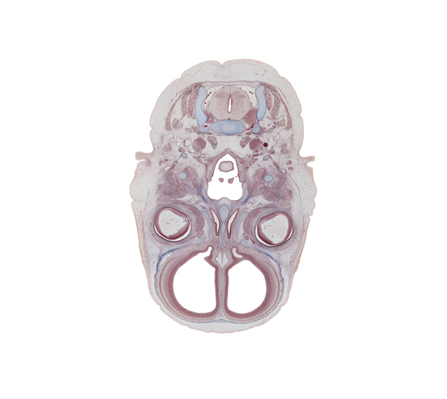 C-3 spinal ganglion, caudal part of auricle, crista galli, edge of epiglottis, edge of unfused palatine shelf, ethmoid, falx cerebri region, frontal bone ossification, internal carotid artery, laryngeal pharynx, lateral ventricle, nasal cavity (nasal sac), nasopharynx, notochord, olfactory bulb, olfactory ventricle, oropharynx, styloid process, superior pharyngeal constrictor muscle, superior sagittal sinus