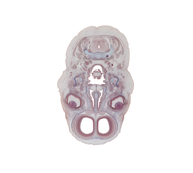 C-3 / C-4 interganglion region, centrum of C-3 vertebra, falx cerebri region, junction of palatine shelves, laryngeal pharynx, lateral pterygoid muscle, lens, nasal cavity (nasal sac), nasal septal cartilage, nasal septum, olfactory bulb, olfactory epithelium (placode), olfactory filia (CN I), oropharynx, pharyngeal arch 1 cartilage (Meckel), pharyngeal arch 2 cartilage, ramus of mandible ossification, superior nasal concha, vertebral artery