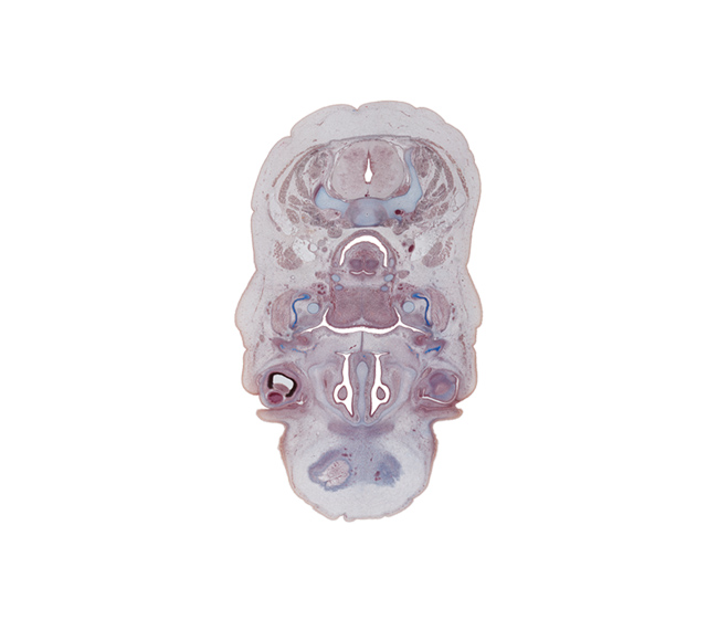 C-5 spinal ganglion, arytenoid swelling, conjunctival sac, dorsal funiculus, edge of frontal bone ossification, edge of middle nasal concha, edge of subarachnoid space, internal jugular vein, junction of eyelids, laryngeal pharynx, lateral funiculus, lower eyelid, nasal capsule cartilage, oral cavity, orbicularis oculi muscle, submandibular ganglion, superior cervical sympathetic ganglion, tooth bud(s), upper eyelid, vagus nerve (CN X), ventral funiculus