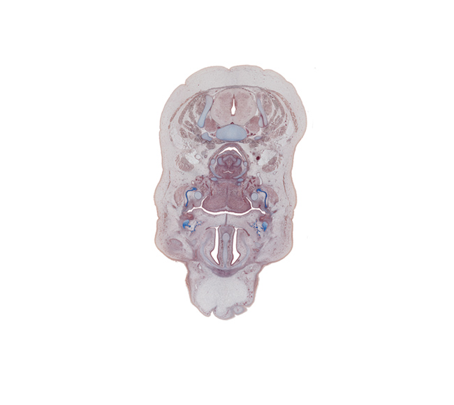 C-5 spinal ganglion, arytenoid cartilage, buccinator muscle, horizontal layer of intrinsic muscles of tongue, inferior pharyngeal constrictor muscle, interorbital ligament, junction of cartilages of pharyngeal arches 2 and 3, laryngeal pharynx, nasal capsule, nasal cavity (nasal sac), oral cavity, parotid duct, pharyngeal arch 1 cartilage (Meckel), platysma muscle, subcutaneous tissue of forehead, submandibular ganglion, surface ectoderm, thyroid cartilage, trapezius muscle