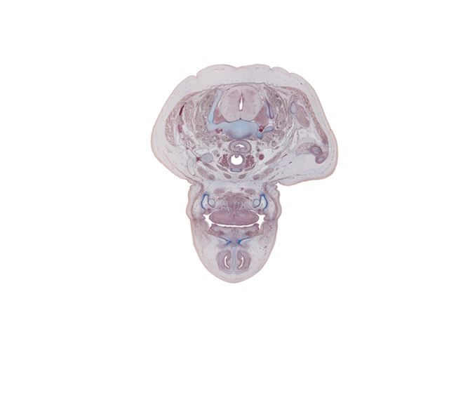 C-7 spinal ganglion, anterior belly of digastric muscle, body of mandible ossification, dorsum of tongue, edge of cricoid cartilage, levator scapulae muscle, muscular layer of esophagus, nasal cavity (nasal sac), nose, pharyngeal arch 1 cartilage (Meckel), retro-esophageal space, supraclavicular fossa region, thyroid gland, tooth bud(s), tracheal lumen