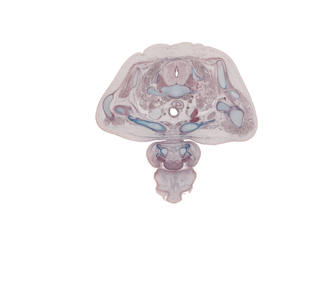 C-8 spinal ganglion, central canal, clavicle, deltoid muscle, dorsal median septum, lower cervical sympathetic ganglion, lower trunk of brachial plexus (C-8, T-1), platysma muscle, retro-esophageal space, rhomboid minor muscle, right recurrent laryngeal nerve, scalene anterior muscle, scalenius medius muscle, superior belly of omohyoid muscle, supraspinatus muscle, trapezius muscle, upper lip, vagus nerve (CN X), ventral median septum