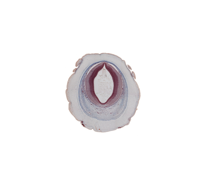 cerebral aqueduct (mesocoele), intermediate zone, loose connective tissue, marginal zone, osteogenic layer, pericranium, roof plate of mesencephalon, subarachnoid space, surface ectoderm, ventricular zone