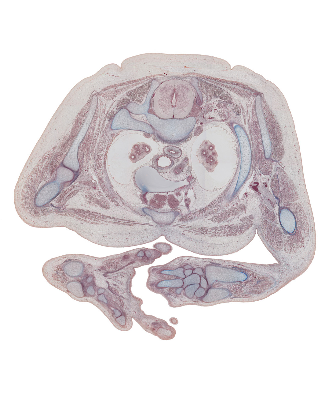 T-2 spinal ganglion, arch of aorta, centrum of T-2 vertebra, coracobrachialis muscle, edge of chin, external intercostal muscle(s), iliocostalis muscle, internal intercostal muscle(s), left subclavian artery, longissimus muscle, lumbrical muscle, metacarpal of digit 3 (middle finger), pleural cavity, radius, rib 2, right lobe of lobulated thymus gland, scapula, short head of biceps brachii muscle, spinalis muscle, subscapularis muscle, sympathetic trunk, ulna, upper lobe of left lung, upper lobe of right lung